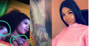 bbnaija Tacha burnt knucles